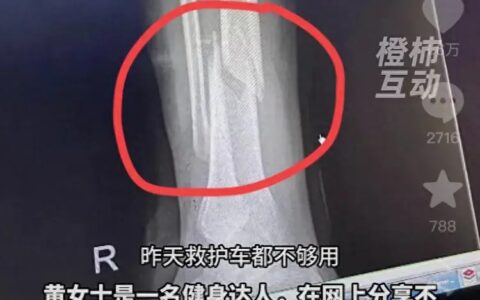 闹大了，女子参加《快乐向前冲》摔断腿冲上热搜，评论区炸锅