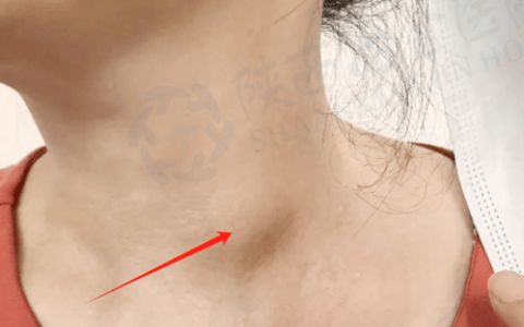 甲状腺结节并不等同于癌！良、恶性各有什么超声特征？-恶性甲状腺结节超声提示